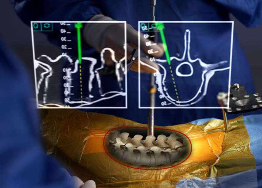 春节汇总：苹果AI眼镜，Meta VR战略，PICO Project Swan