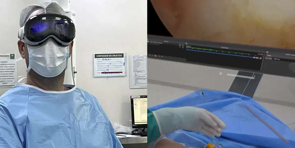 巴西医生用苹果Vision Pro辅助完成肩关节镜手术